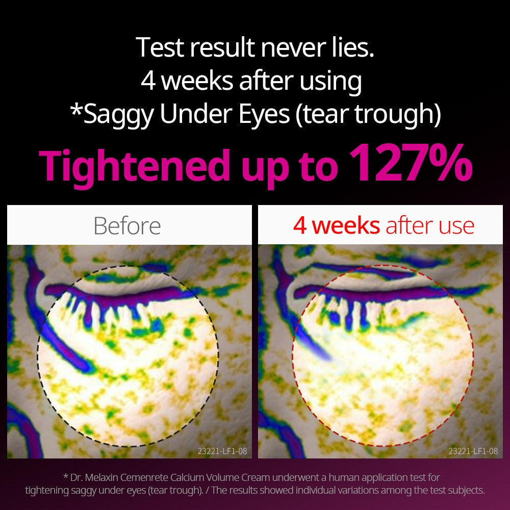 Dr.Melaxin CEMENRETE EYE CREAM